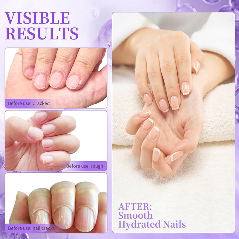 NailSoothe – Stylo à huile nourrissant pour repousse-cuticules