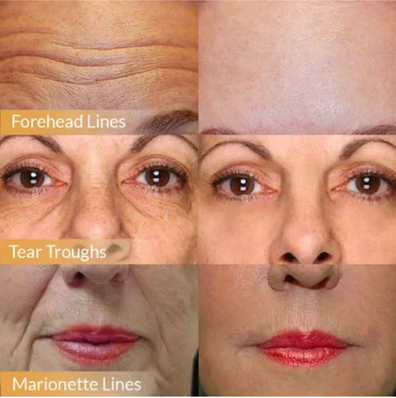 DermaLift – Crème Visage Raffermissante aux Polypeptides